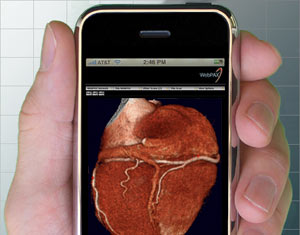 02330b_iphoneheartit