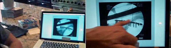 06024c_armstrongclavicola